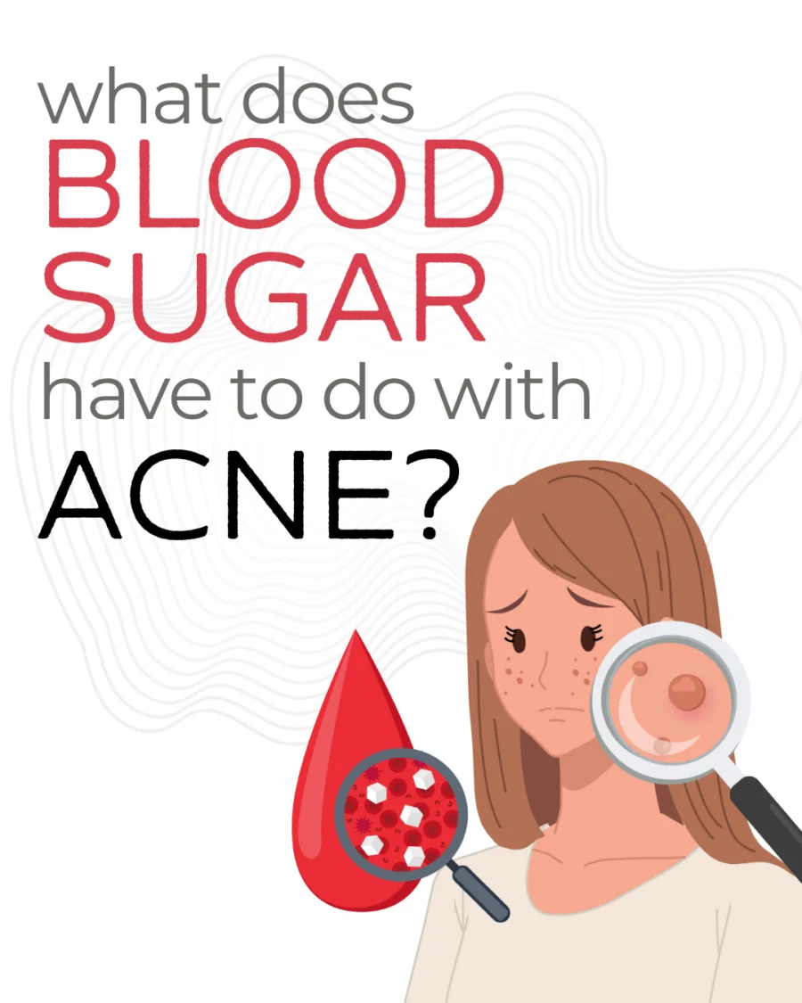 Tackling Acne by Balancing Blood Sugar and Hormones